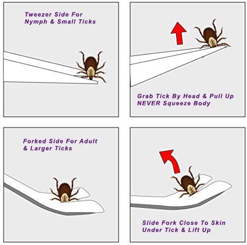 eTradewinds Tick Remover Tool Kit Tweezers & Tick Identifier Card - Hygienic All Stainless Steel Tick Removal Instrument Ideal for Human, Dog, Cat & General Pet Tick Puller w/Leather Case