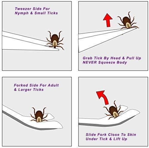 eTradewinds Tick Remover Tool | Tick-Off Pro | Hygienic All Stainless Steel Tick Removal Tool with Leather Case (2-Pack)