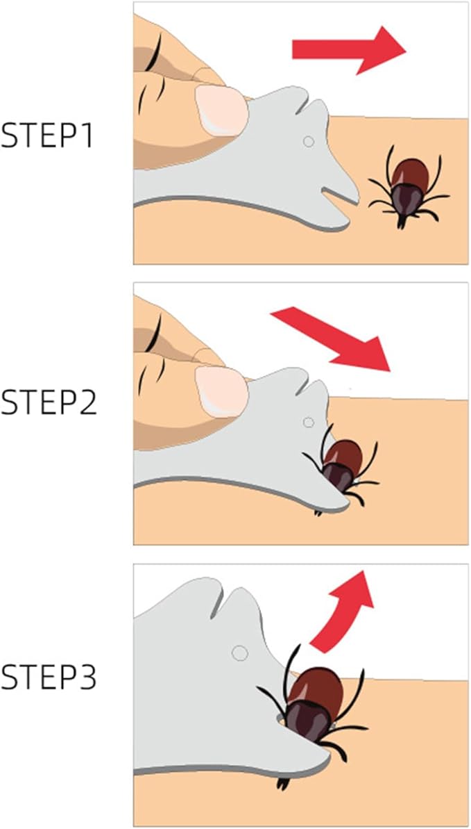Pet Tick Remover Card Style Tick Removal Tool Easy to Carry Card Tick Catching with Magnifier for Pets Dogs Cat Tick Remover Tool for People Tick Remover Tool Tick Remover for Human