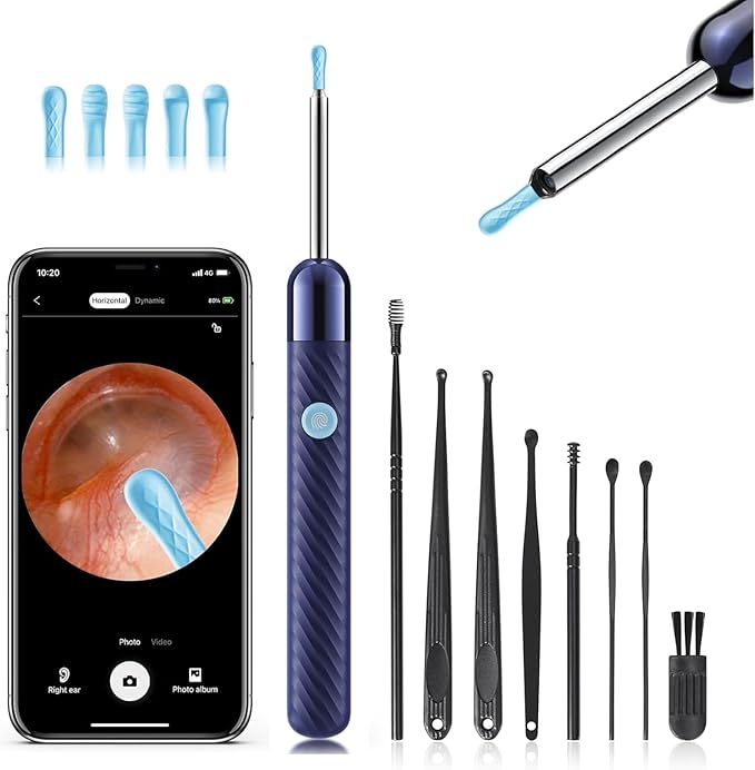 Loyker Ear Wax Removal, Ear Cleaner with Camera with 1080P, Otoscope with Light, Ear Wax Removal Kit with 6 Ear Pick, Ear Camera for iPhone, iPad, Android Phones (Blue)