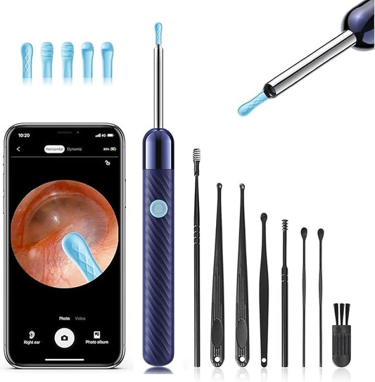 Loyker Ear Wax Removal, Ear Cleaner with Camera with 1080P, Otoscope with Light, Ear Wax Removal Kit with 6 Ear Pick, Ear Camera for iPhone, iPad, Android Phones (Blue)
