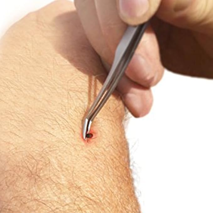 eTradewinds Tick Remover Tool | Hygienic All Stainless Steel Tick Removal Tool with Leather Case (6-Pack)