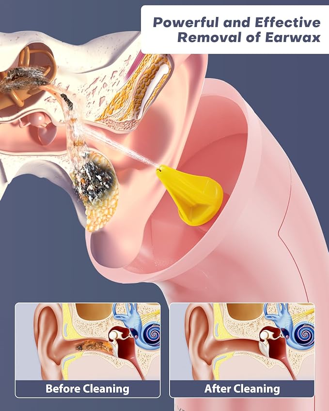Upgraded Ear Wax Removal Kit, One Piece Waste Tank - Ear Irrigation Flushing System with 4 Modes & 8 Nozzles - IPX7, Safe and Effective Electric Ear Cleaner for Family Use, Type-C (Pink)
