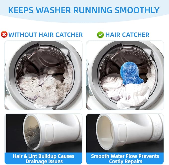 6 PCS Pet Hair Remover for Laundry – Effectively Removes Fur, Lint & Dander – Reusable, Eco-Friendly Laundry Pet Hair Catcher – Gentle on Clothes, Protects Machine, Easy to Use & Clean (Blue)