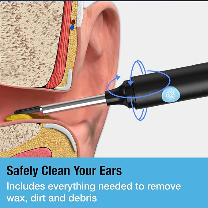 Ear Wax Removal Tool with Ear Camera by Tilcare - Ear Irrigation Flushing System for Adults & Kids - Perfect Ear Cleaning Kit - includes Basin, Syringe, Curette Kit, Towel and 30 Disposable Tips