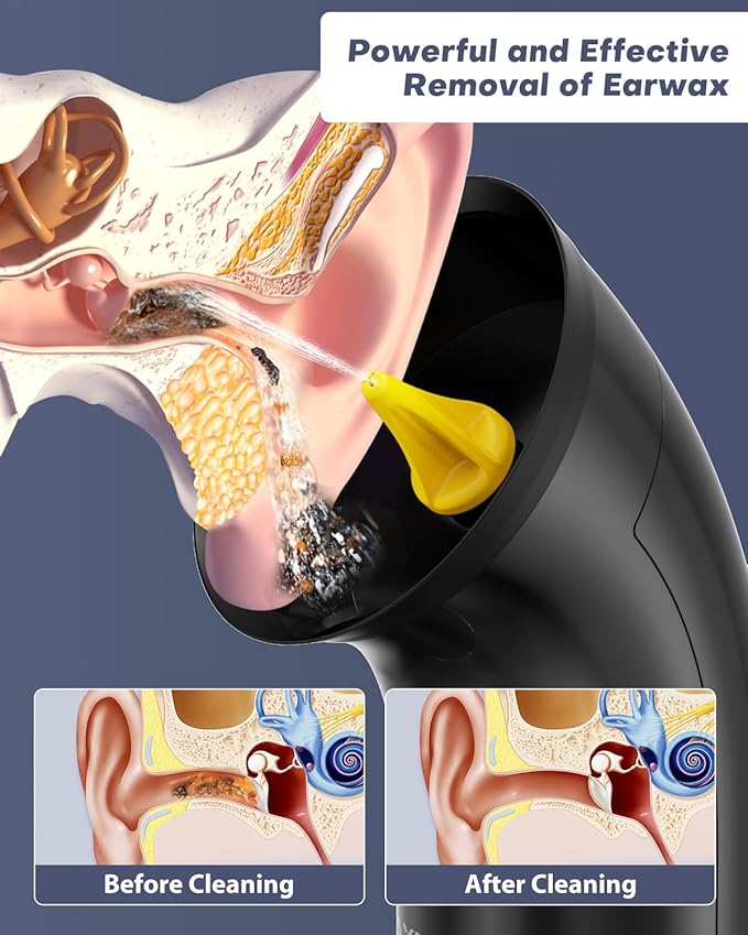 Upgraded Ear Wax Removal Kit, One Piece Waste Tank - Ear Irrigation Flushing System with 4 Modes & 8 Nozzles - IPX7, Safe and Effective Electric Ear Cleaner for Family Use, Type-C (Gray)