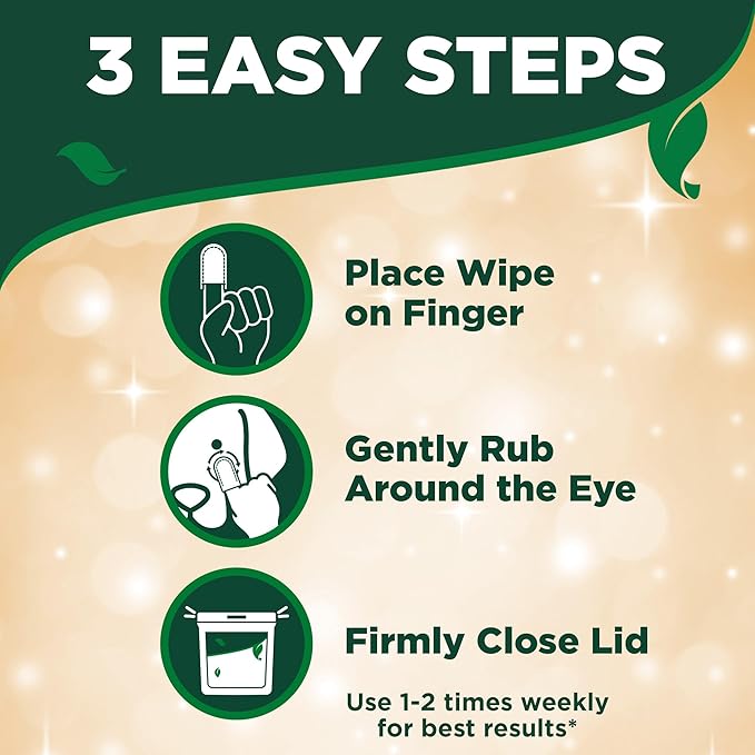 Vet's Best Eye Cleansing Wipes for Dogs, Gentle Tear Stain Remover For Dogs, Eye Wipes for Dogs with Aloe Vera & Witch Hazel (50 Count Dog Eye Wipes)