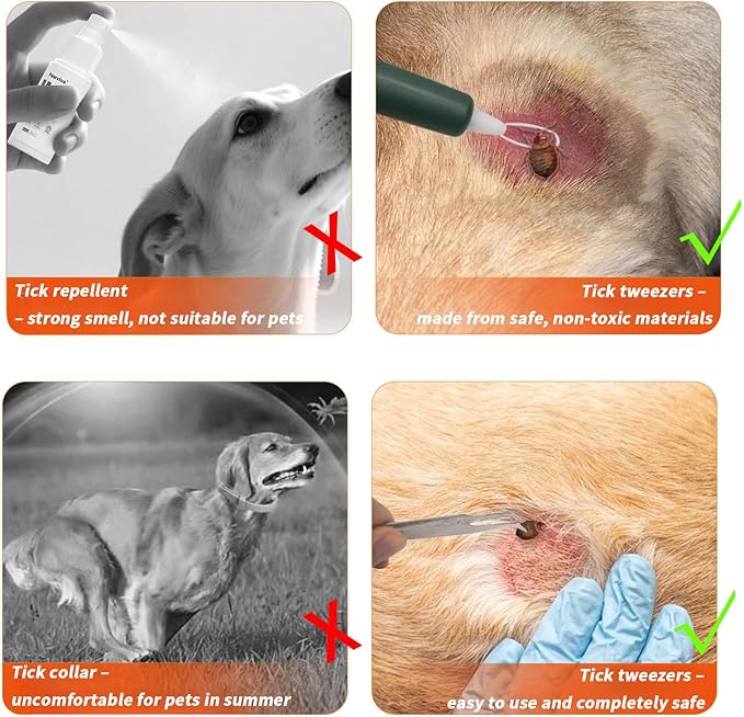 Premium Tick Remover Kit for Humans and Dogs - 54 in 1 Hiking Essentials with First Aid Case, Stainless Steel Tick Remover + Tweezers, Tick Remover Tools for Dogs Cats Pet Tick Comb