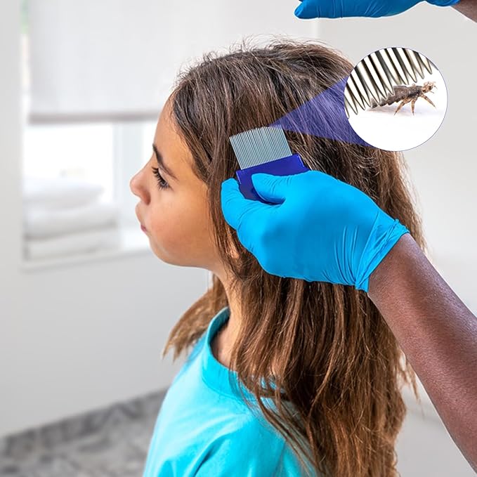 Lice Comb, 8 Pcs Flea Comb, Hair Double Sided Fine Tooth Combs, Removal Dandruff,with Metal Teeth,Stainless Steel Louse and Nit Combs for Head Lice Treatment