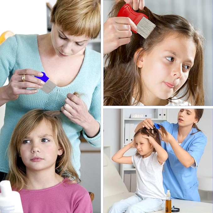 Lice Comb, 8 Pcs Flea Comb, Hair Double Sided Fine Tooth Combs, Removal Dandruff,with Metal Teeth,Stainless Steel Louse and Nit Combs for Head Lice Treatment