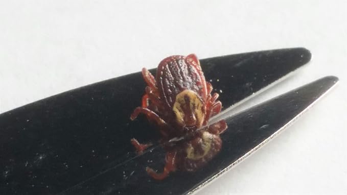 ProTick Remedy (2 Pack) – Precision Steel Tick Remover, Magnifier, Chain, Tick ID Card, Tick ID Information. Helps Deal with All Ticks Sizes from Humans and Animals