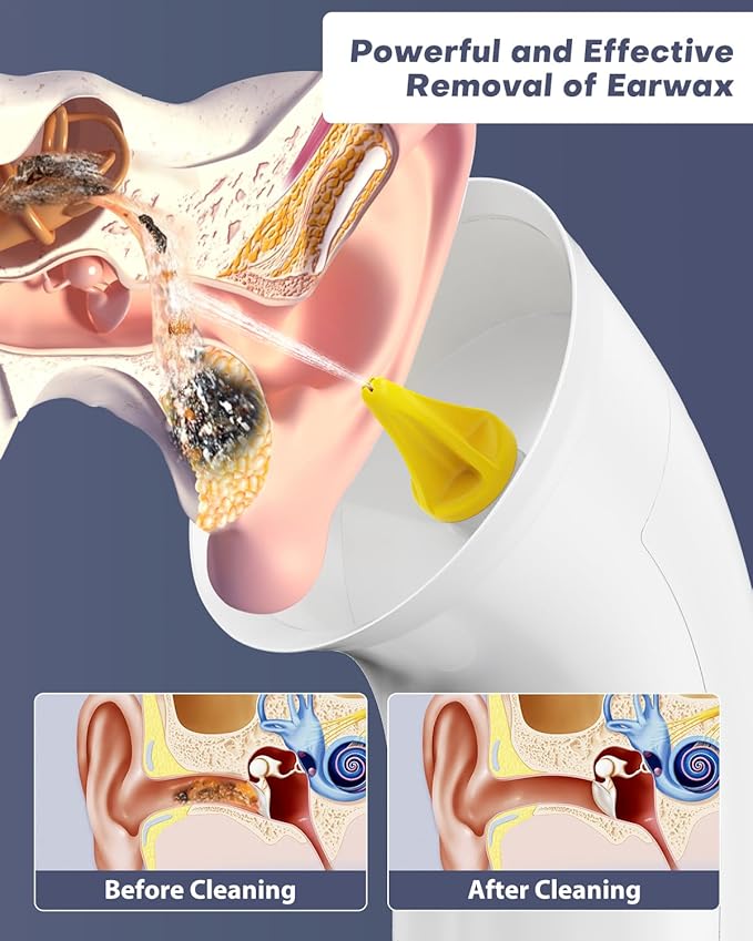 Upgraded Ear Wax Removal Kit, One Piece Waste Tank - Ear Irrigation Flushing System with 4 Modes & 8 Nozzles - IPX7, Safe and Effective Electric Ear Cleaner for Family Use, Type-C (White)