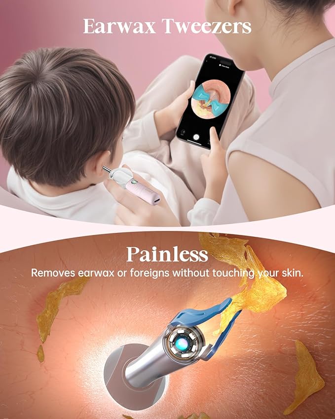 Ear Wax Removal Tool Camera, Ear Cleaning Kit with Flexible Visual Ear Camera Otoscope, Portable Wireless Painless Ear Cleaner with Earwax Remover Tweezers for Adults Kids Pets(Pink)