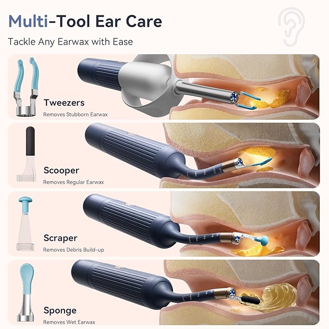 Ear Wax Removal Kit: Smart Visual Ear Cleaner with Camera 1080P HD for Adults & Kids - Flexible Ear Wax Remover with 6 LED Lights - Safe Ear Cleaning Tool for Home Use