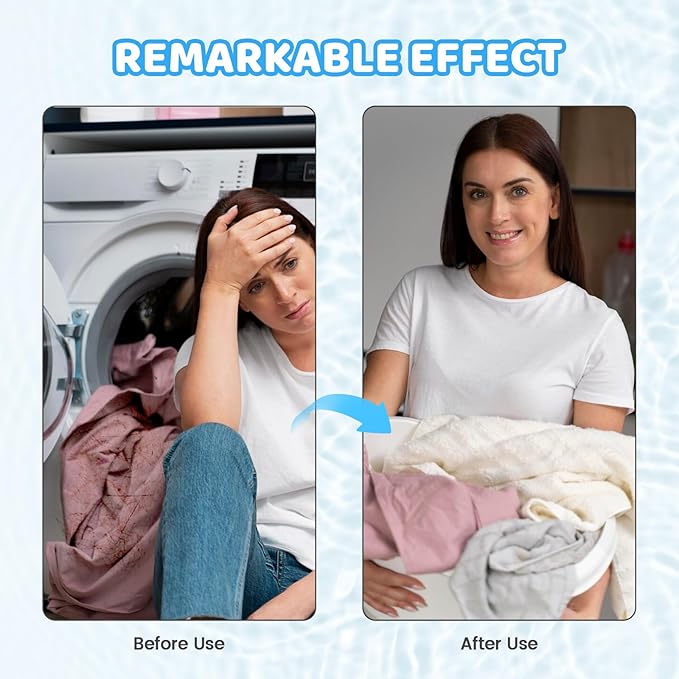 5 Pcs Pet Hair Remover for Laundry, Reusable Pet Hair Lint Catcher for Washing Machine, Washing Machine Hair Catcher Lint Remover for Clothes Dryer, Cat Pet Dog Hair Remover for Laundry