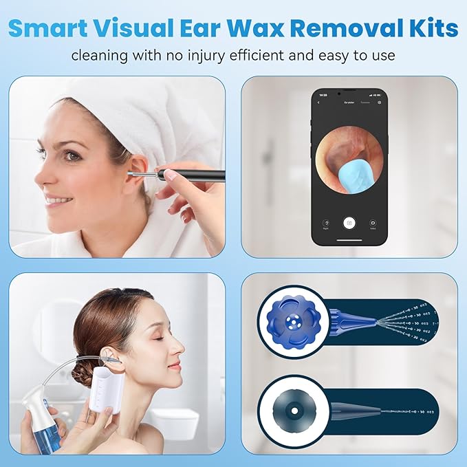 Ear Wax Removal - Ear Cleaner - Ear Camera - Ear Wax Removal Kit - Ear Wax Removal Tool Camera - 1080HD Effective for Cleaning Ear Wax Build-Up