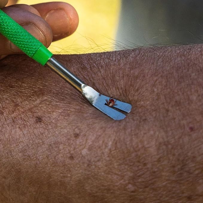 TickCheck Premium Tick Remover Kit - Stainless Steel Tick Remover + Tweezers, Leather Case, and Free Pocket Tick Identification Card (2 Sets)