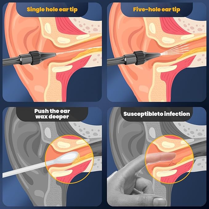 Ear Wax Removal - Electric Ear Cleaner - Ear Irrigation Kit Safe Ear Irrigation Flushing System with 4 Pressure Settings - Effective Ear Wax Removal Tool for Earwax Buildup (Dark Blue)