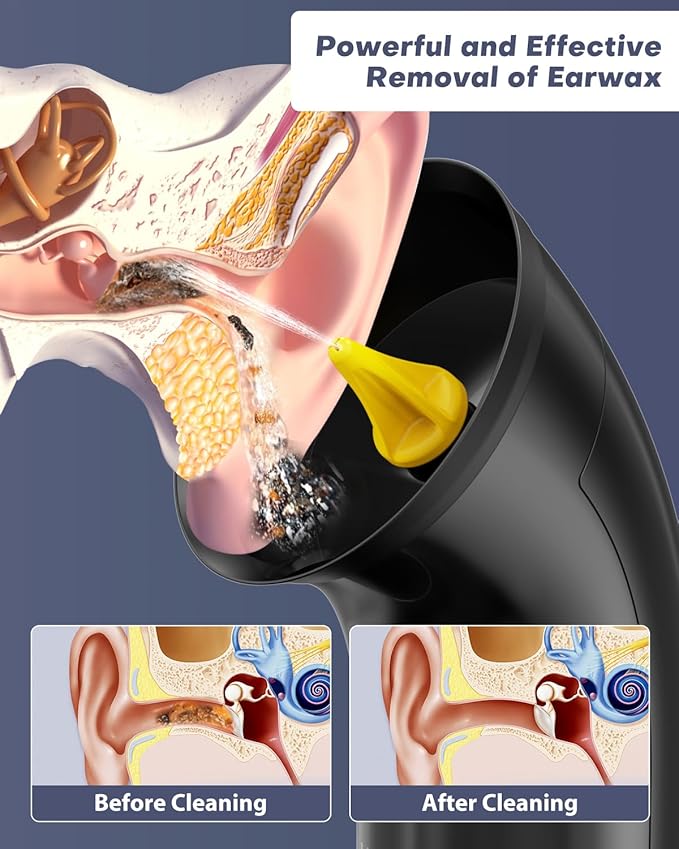 Upgraded Ear Wax Removal Kit, One Piece Waste Tank - Ear Irrigation Flushing System with 4 Modes & 8 Nozzles - IPX7, Safe and Effective Electric Ear Cleaner for Family Use, Type-C (Black)