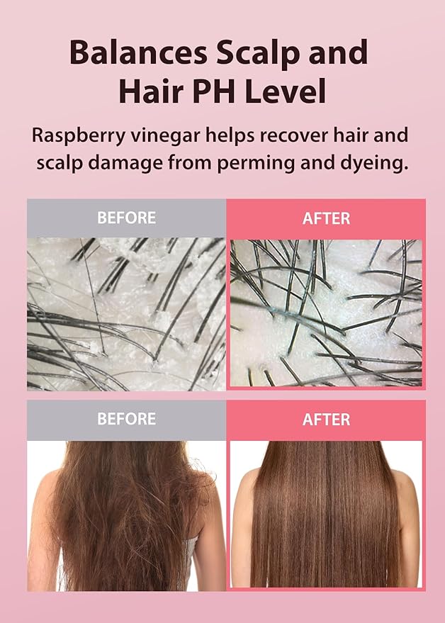 A’PIEU Raspberry Vinegar Hair Shampoo - Dandruff & Clarifying Shampoo with Scalp Treatment. Balances pH, Removes Buildup, Soothes Scalp. Korean Hair Care. 16.9 fl.oz