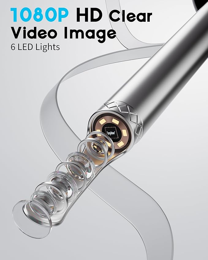 Loyker X6 Ear Wax Removal Tool Camera, Ear Cleaner with Camera, FSA - HSA Store Eligible, 1080P Ear Camera with 6LED Light for Ear/Nose/Throat/Tonsil Stone Examination, Black