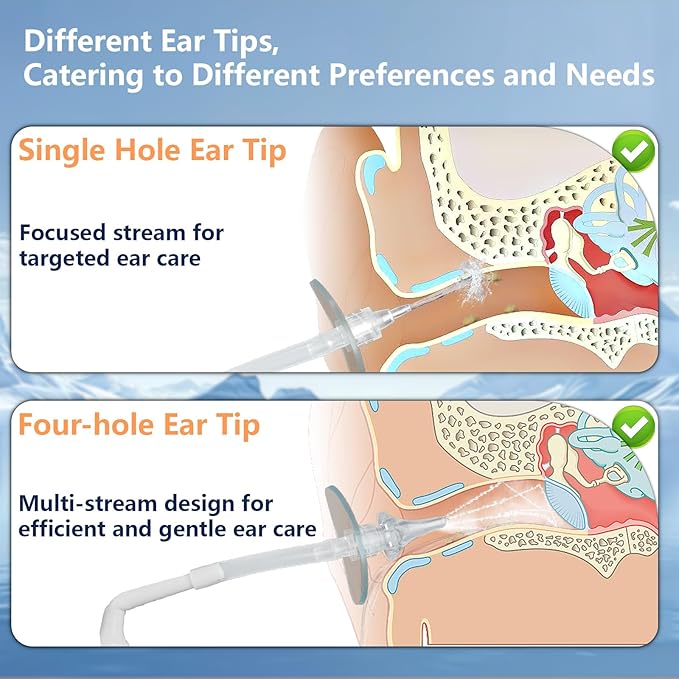 Ear Wax Removal Tool, Ear Cleaning Kits Safe Ear Irrigation Kit Ear Flush Kit for Adults Kids, Ear Wax Washer Device with LED Earwax Spoon, Basin, Bulb, Curette Kit, Towel, Tips, Storage Box Green