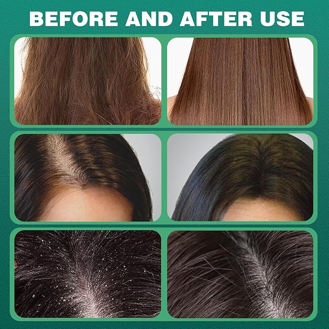 2PC Seven Green Shampoo Bar - Nature Shampoo Bar with Grass Extract, Green Soap for Women & Men