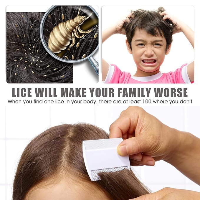 Lice Comb Flea Comb For Cats Dog Pet Comb Set Metal Fine Tooth Remove Tear Marks Float Hair Dandruff (B)