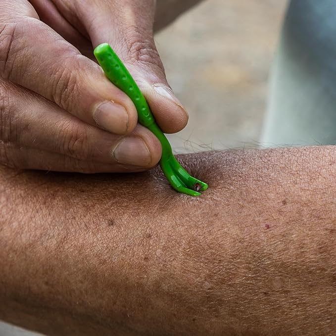 TickCheck Tick Remover Value 3 Pack - Tick Remover Tools + Tick Identification Card - for Humans, Dogs & Cats (70)